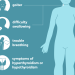 Understanding the symptoms of iodine deficiency