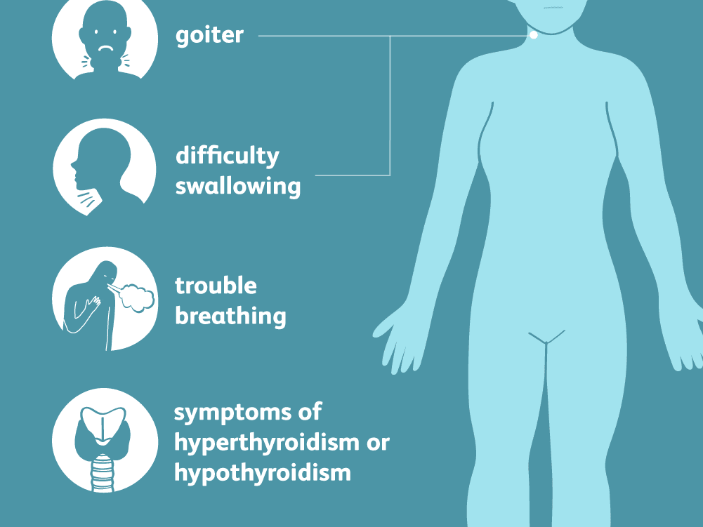 Understanding the symptoms of iodine deficiency