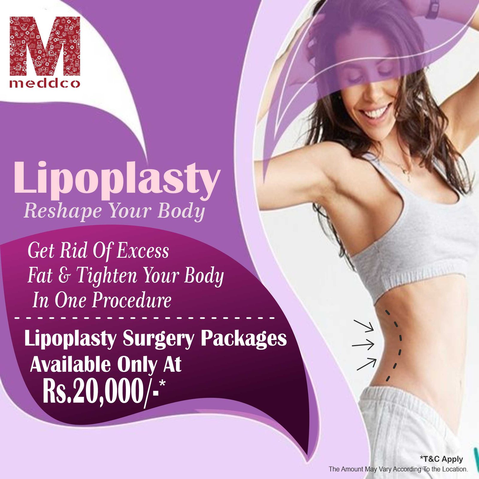 lipoplasty