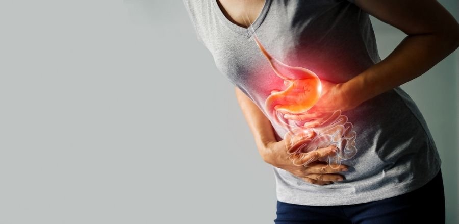 irritable bowel syndrome