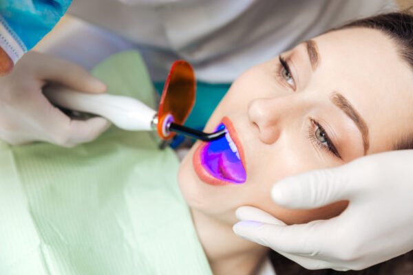 laser teeth whitening