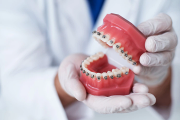<strong>What Are the Benefits of Orthodontics?</strong>
